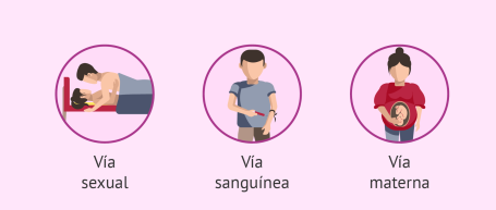 Formas de trasmisión del VIH